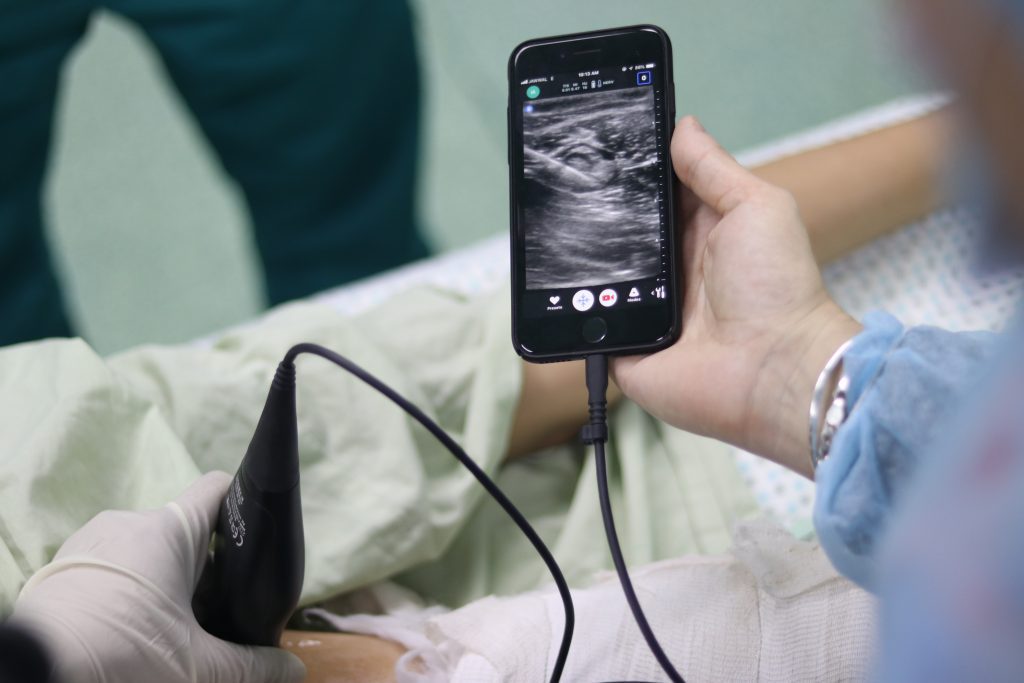 MedGlobal partner, the Butterfly Network, provided the hand-held ultrasound scanners called Butterfly iQs. 